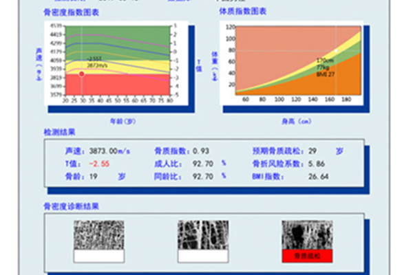 骨密度正常值对照表